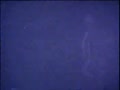 Хiрургiчна iнфекцiя у новонароджених