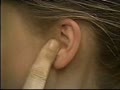 insp outer ear
