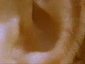 vestibular organ child